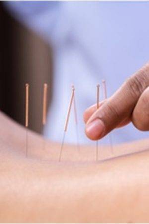 Acupuncture and acupressure
