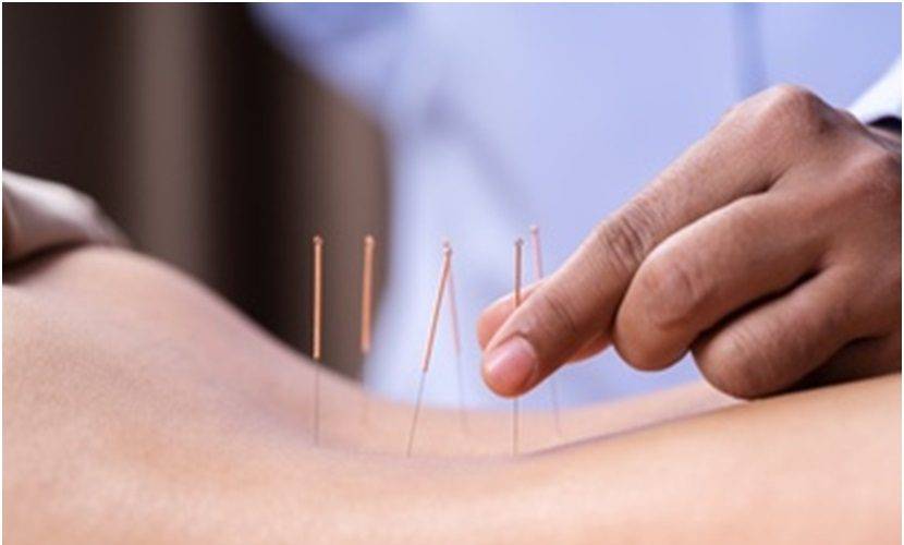 Acupuncture and acupressure