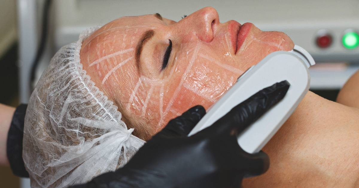 HIFU Facial: Procedure and Side Effects